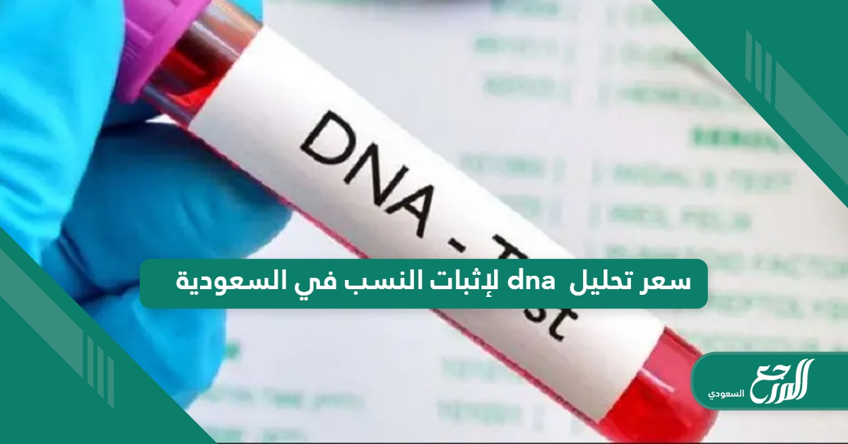 كم سعر تحليل dna لإثبات النسب في السعودية